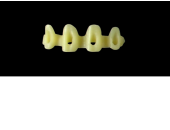 Cod.E3 f Upper Anterior: 10x  hollow pontics blocks-frames, (12-22), carved to fit into wax veneers Cod.E3Upper Anterior, MEDIUM, (13-23), for porcelain pressed to metal bridgework